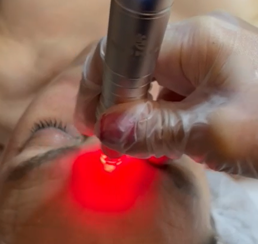 UTSUKUSY ENPITSU DERMA PEN PRO.7 MEZOTERAPIJOS PRIETAISAS