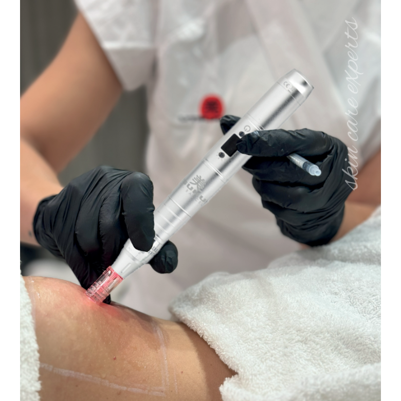 UTSUKUSY ENPITSU DERMA PEN PRO.7 MEZOTERAPIJOS PRIETAISAS